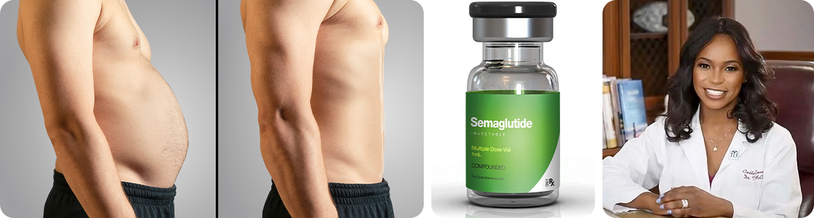 Semaglutide Weight Loss